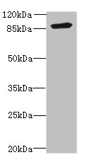 FGFR3 Polyclonal Antibody