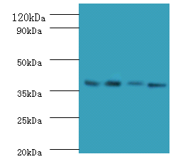 FCGRT Polyclonal Antibody