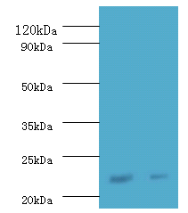 IFNA21 Polyclonal Antibody