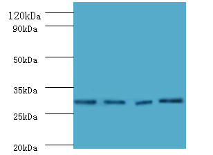 Mmp7 Polyclonal Antibody