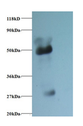 Alpha1-Acidglycoprotein Polyclonal Antibody