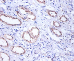 GPI Polyclonal Antibody