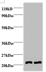 AP2M1 Polyclonal Antibody