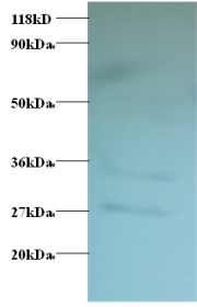 TSTA3 Polyclonal Antibody