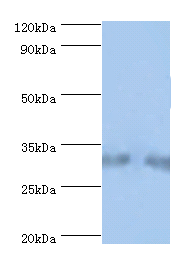 SRM Polyclonal Antibody