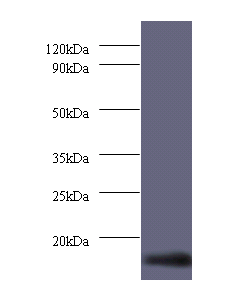 DYNLL1 Polyclonal Antibody