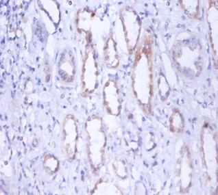 MYH9 Polyclonal Antibody