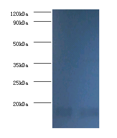 NME1 Polyclonal Antibody