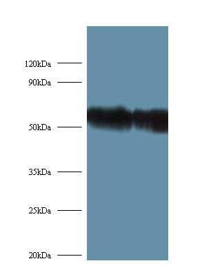 RPS6KB2 Polyclonal Antibody