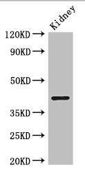 PRMT1 Polyclonal Antibody