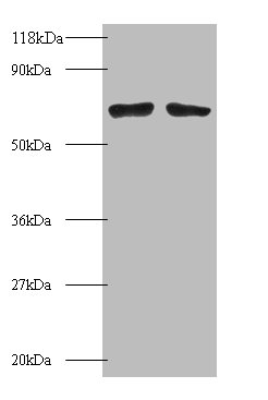 BMI1 Polyclonal Antibody (100 µl)