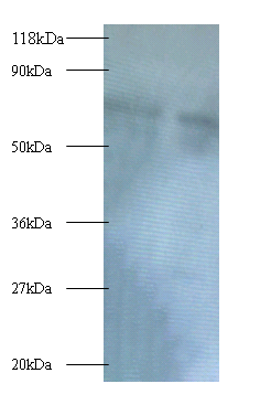 BMI1 Polyclonal Antibody