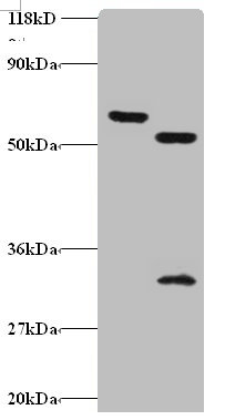 ZNF384 Polyclonal Antibody