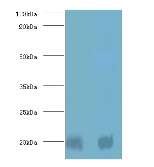 PARK7 Polyclonal Antibody