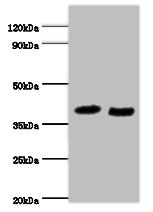 RAD23A Polyclonal Antibody (100 µl)