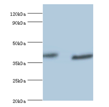 RAD23A Polyclonal Antibody