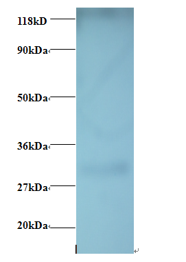 GPR161 Polyclonal Antibody