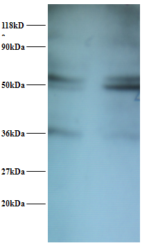 SARS Polyclonal Antibody