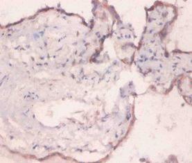 HSPA5 Polyclonal Antibody