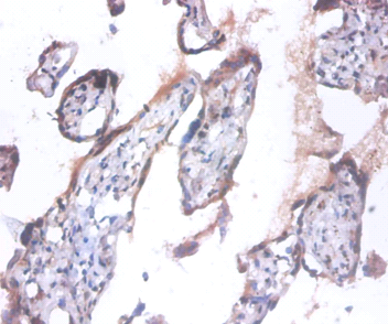 ANAPC5 Polyclonal Antibody