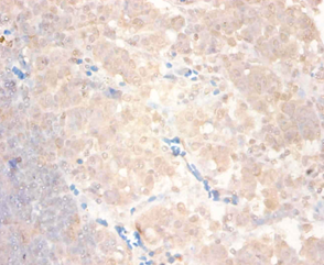 CCL24 Polyclonal Antibody