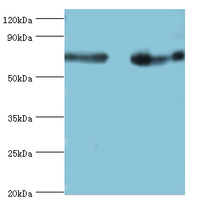 IL12B Polyclonal Antibody