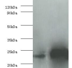 IL6 Polyclonal Antibody