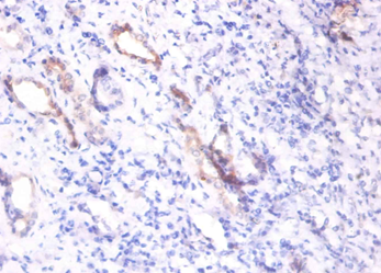 SPP1 Polyclonal Antibody