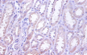 TNFRSF10D Polyclonal Antibody