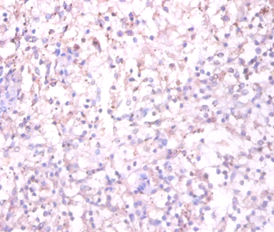 TACR1 Polyclonal Antibody