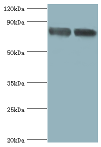 FOLH1 Polyclonal Antibody