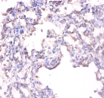Immunohistochemistry of paraffin-embeded human lung at dilution of 1:100