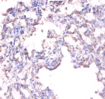 ALPL Polyclonal Antibody