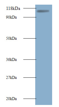 MIB1 Polyclonal Antibody