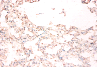 STEAP1 Polyclonal Antibody