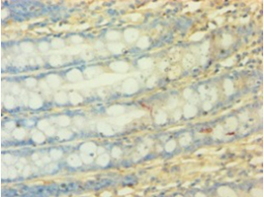 NDUFA3 Polyclonal Antibody