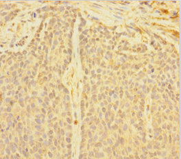 DNTTIP1 Polyclonal Antibody