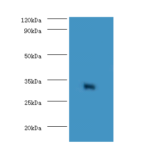 EEF1D Polyclonal Antibody