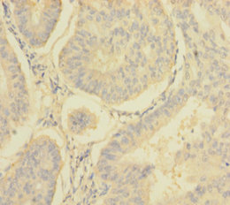 NDUFA6 Polyclonal Antibody