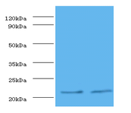 TIMP1 Polyclonal Antibody
