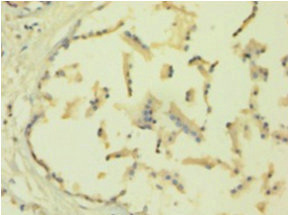 Immunohistochemistry of paraffin-embedded human plastate using TIMP1 Polyclonal Antibody at dilution 1:100.