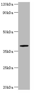 ARSB Polyclonal Antibody (100 µl)