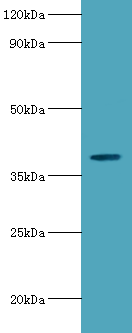 ARSB Polyclonal Antibody