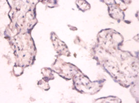 PKMYT1 Polyclonal Antibody (20 µl)