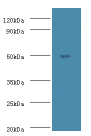 Western blot<br />All lanes: ACTL7A Polyclonal Antibody at 2ug/ml+mouse liver tissue<br />Secondary<br />Goat polyclonal to rabbit at 1/10000 dilution<br />Predicted band size: 49kDa <br />Observed band size: 49kDa <br />