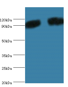 POSTN Polyclonal Antibody