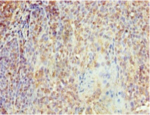 KPNA1 Polyclonal Antibody