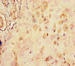 LHB Polyclonal Antibody