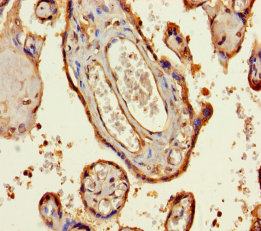 RIPK2 Polyclonal Antibody