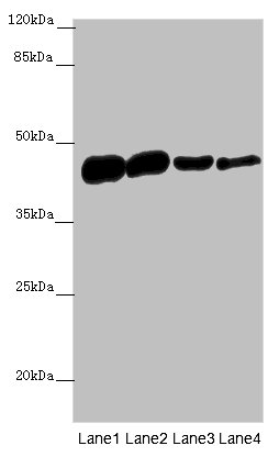 ACTA1 Polyclonal Antibody (100 µl)